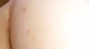 سیکرٹری کی طرف سے مریضوں